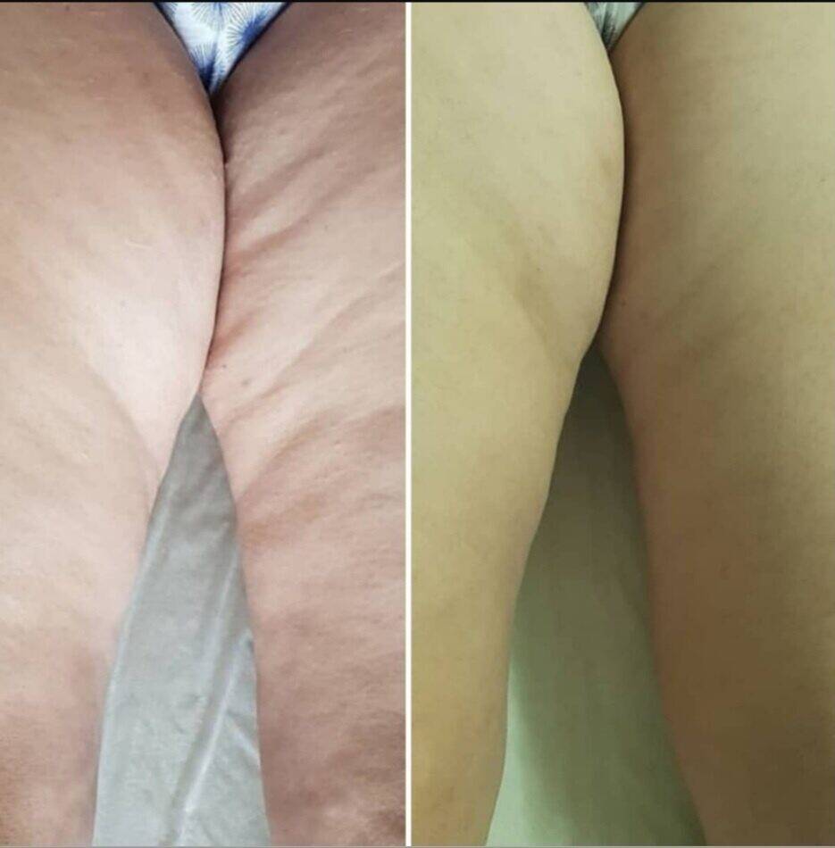 МАССАЖ В САМАРЕ, Оздоровительные сеансы  в Самаре фото 2 Услуги Самара