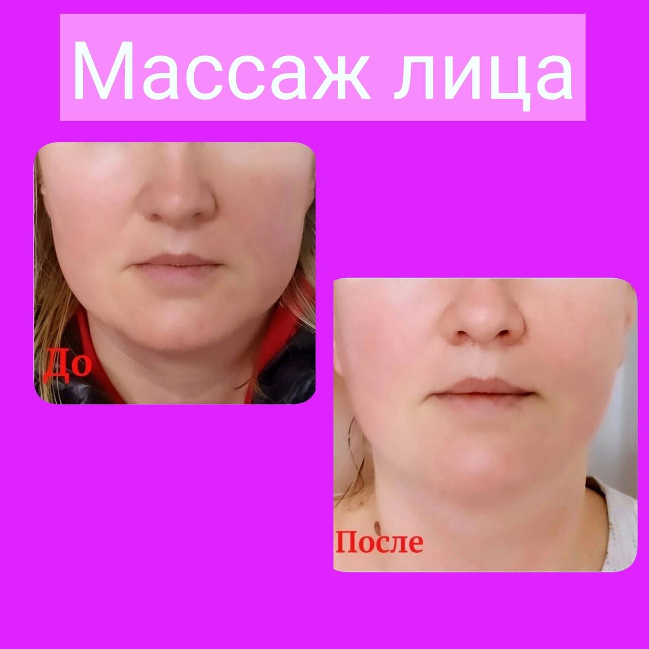 Массаж лица, УЗ-пилинг, микротоки, фонофорез  в Симферополе фото 7 Услуги Симферополь