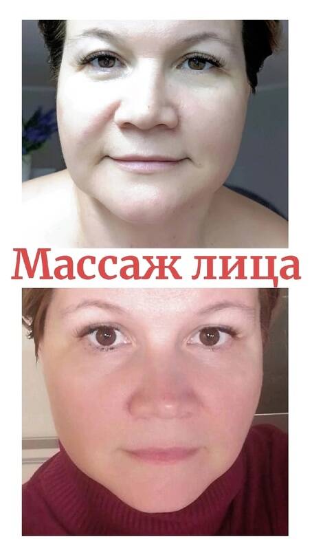 Массаж лица, УЗ-пилинг, микротоки, фонофорез  в Симферополе фото 6 Услуги Симферополь