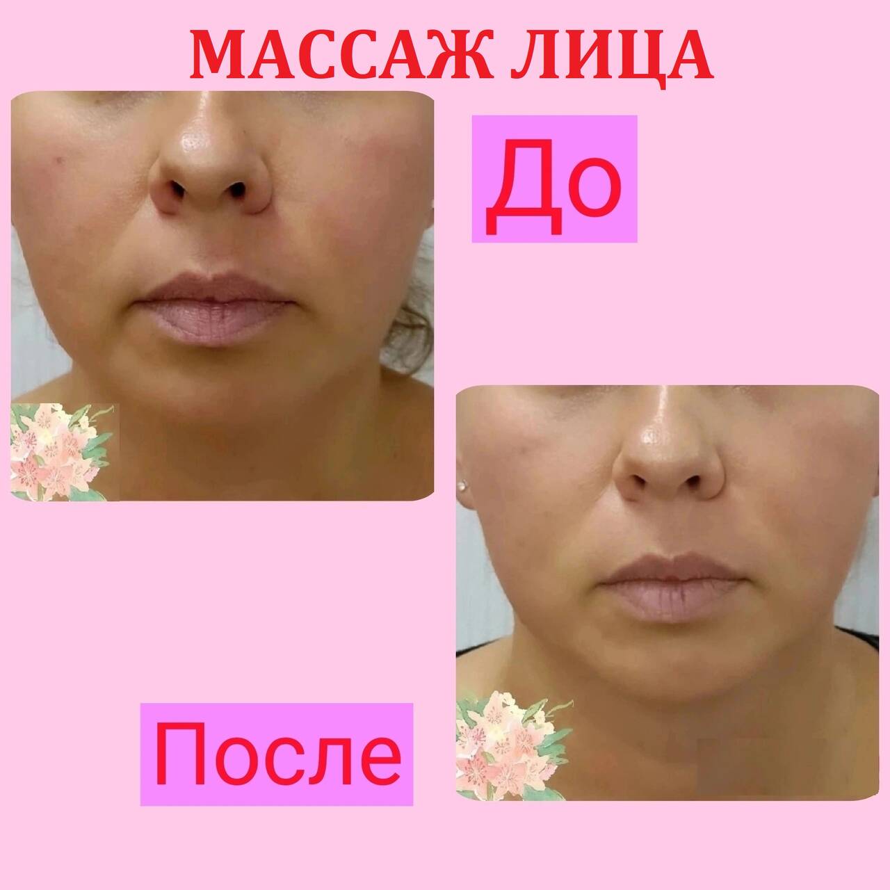 Массаж лица, УЗ-пилинг, микротоки, фонофорез  в Симферополе фото 2 Услуги Симферополь