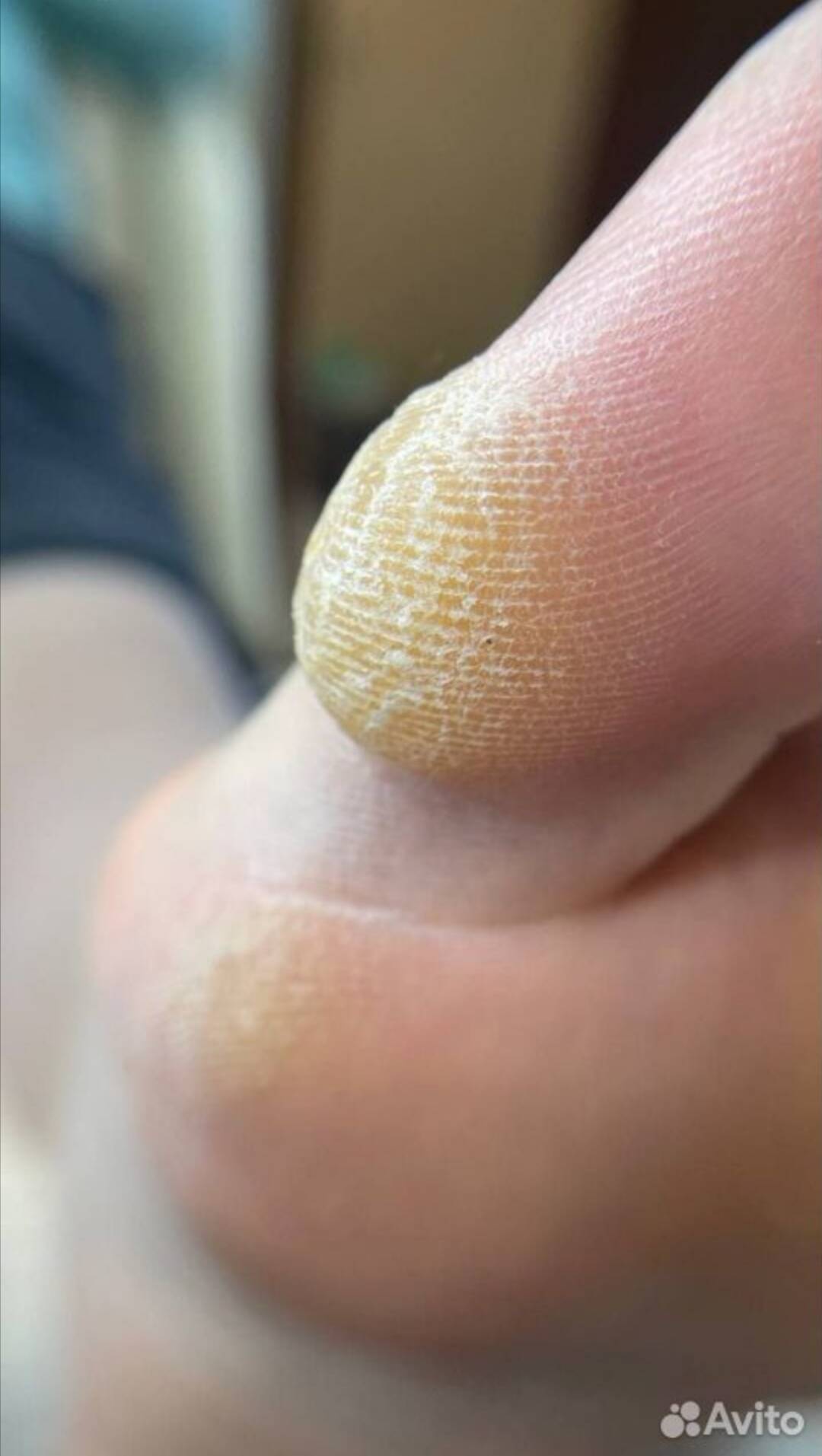 Маникюр/Педикюр  в Воскресенске фото 2 Услуги Воскресенск