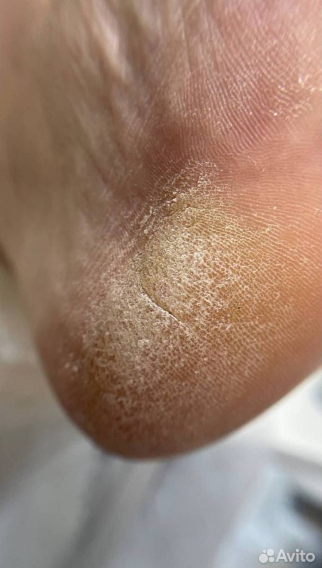 Маникюр/Педикюр  в Воскресенске фото 3 Услуги Воскресенск