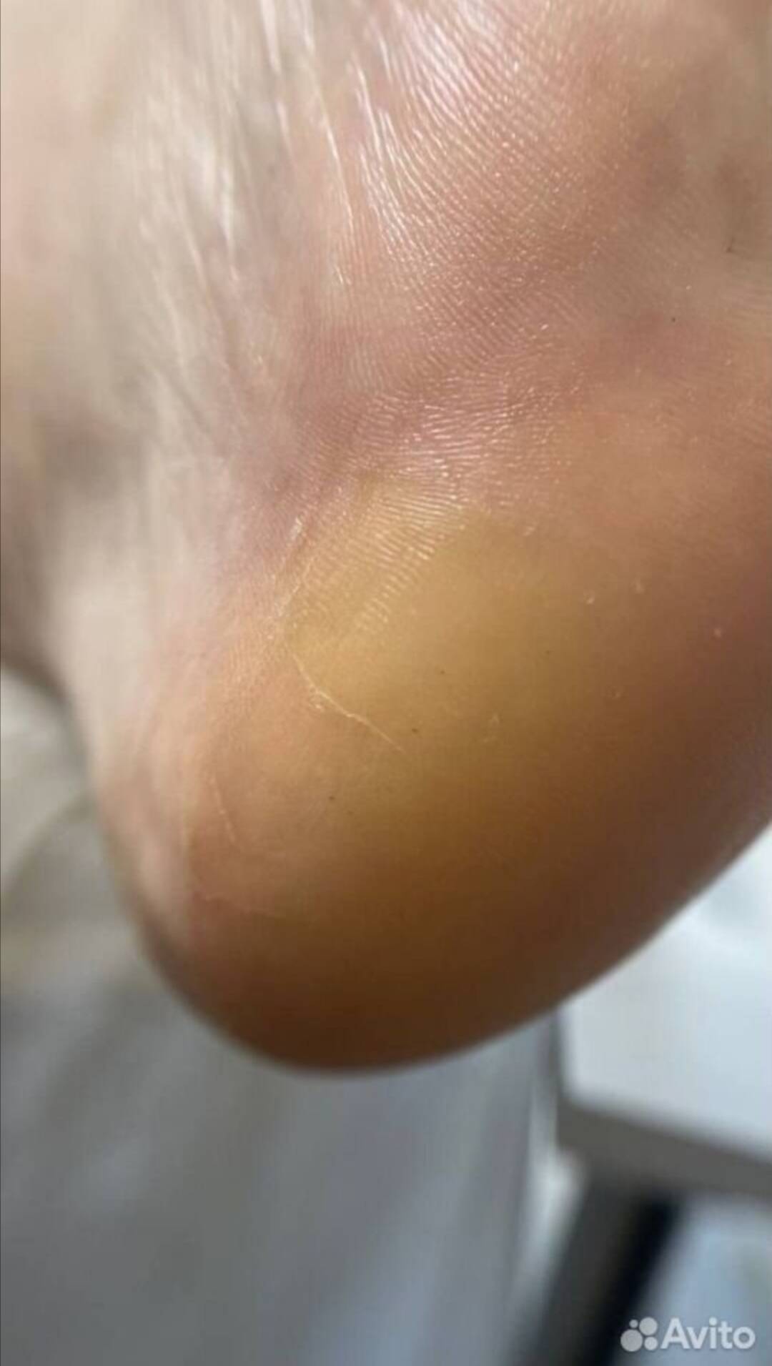 Маникюр/Педикюр  в Воскресенске фото 5 Услуги Воскресенск