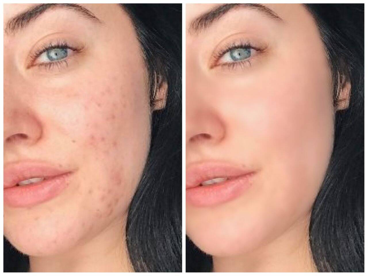 Ретушь фотографий, обработка фото  в Пензе фото 6 Услуги Пенза