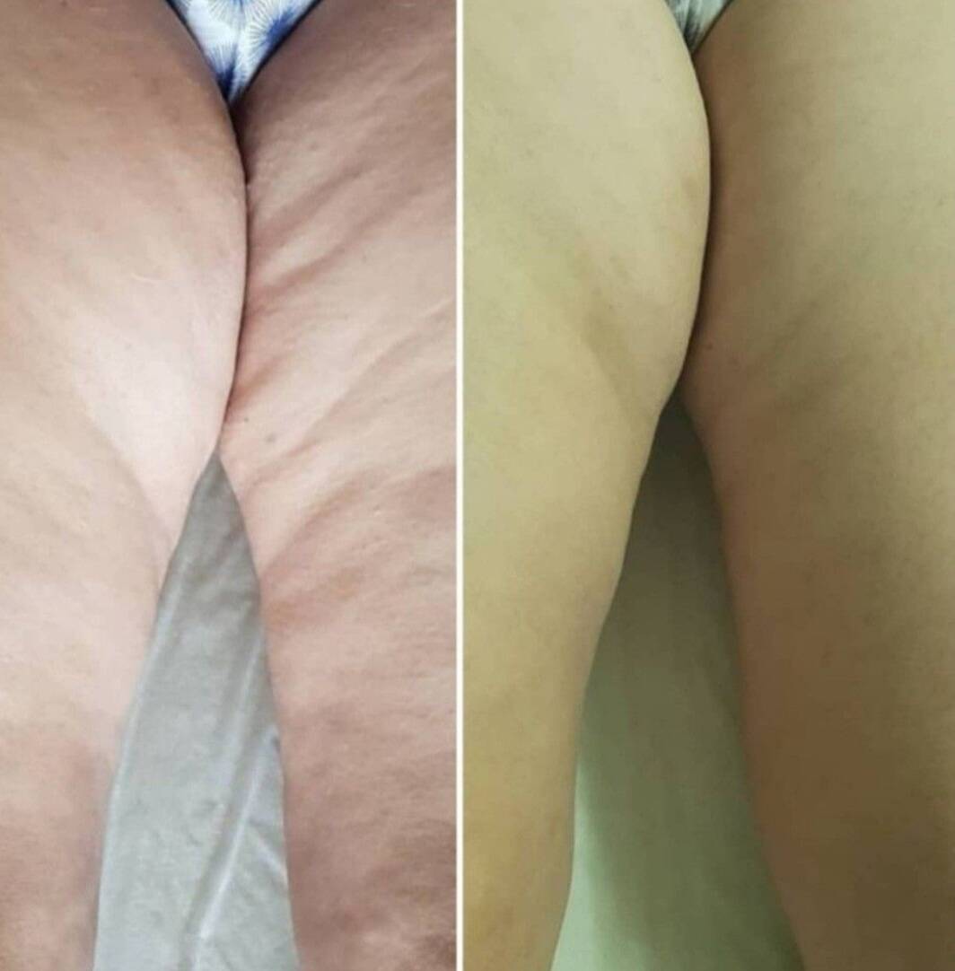 МАССАЖ В САМАРЕ в Самаре фото 4 Услуги Самара МАССАЖ В САМАРЕ в Самаре фото 4 Услуги Самара