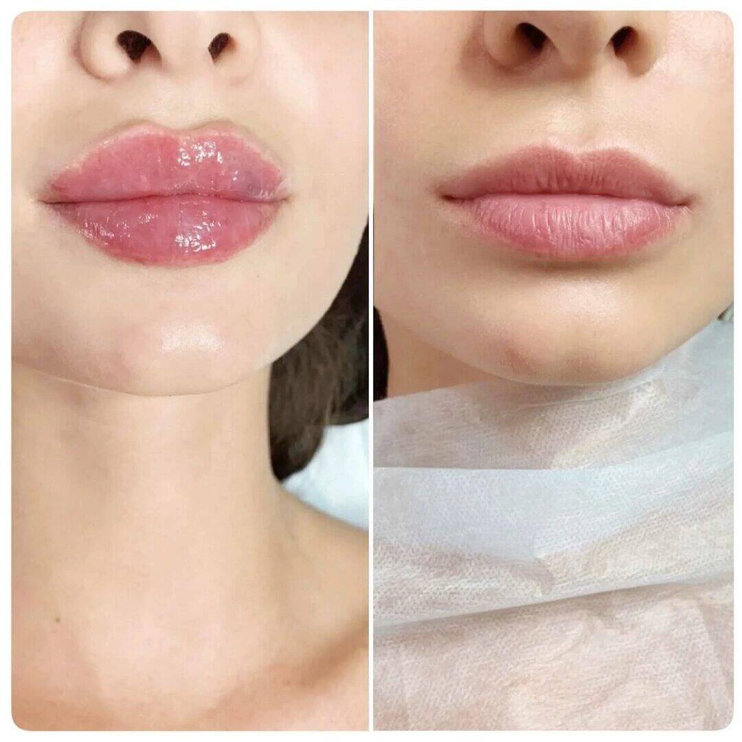 Модель на увиличение губ  в Москве фото 4 Услуги Москва