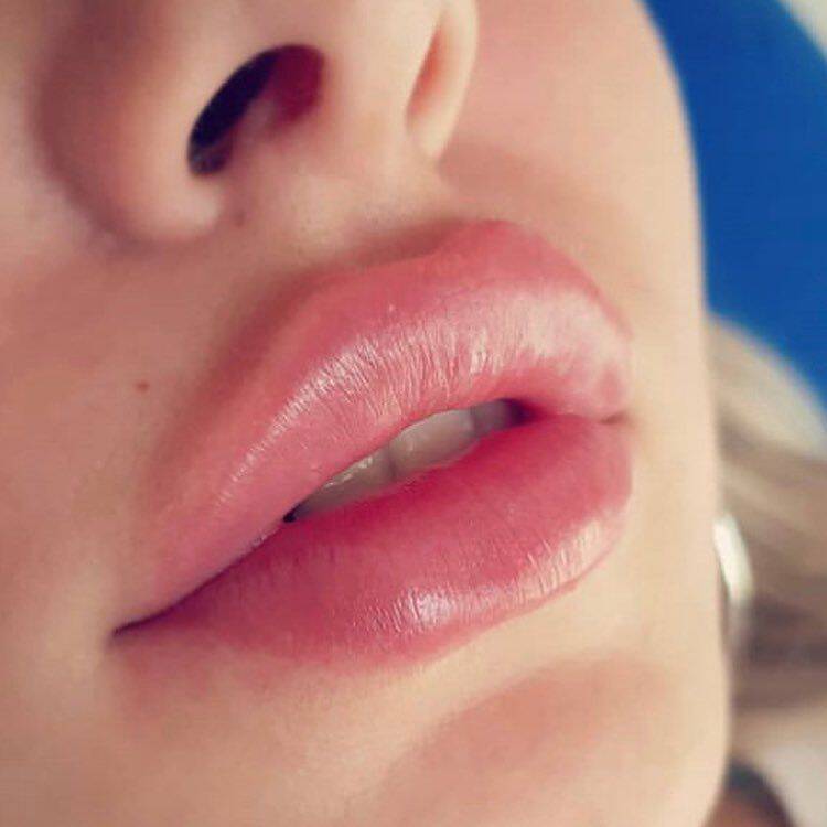 Модель на увиличение губ  в Москве фото 2 Услуги Москва