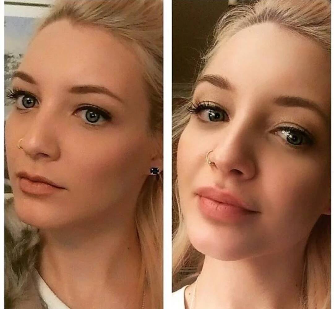 Модель на ботокс и увеличение губ в Москве фото 7 Услуги Москва