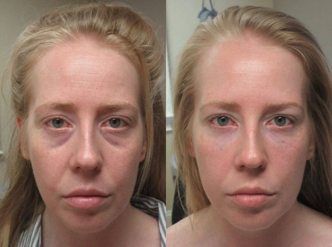 Модель на ботокс и увеличение губ в Москве фото 5 Услуги Москва