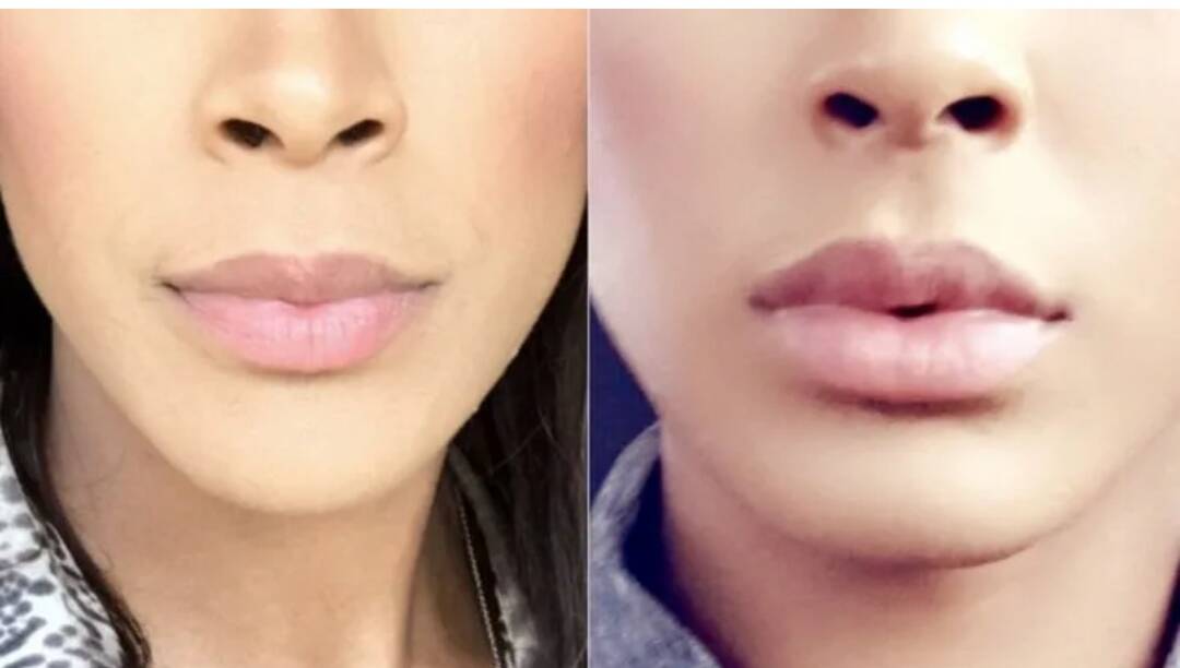 Модель на ботокс и увеличение губ в Москве фото 4 Услуги Москва