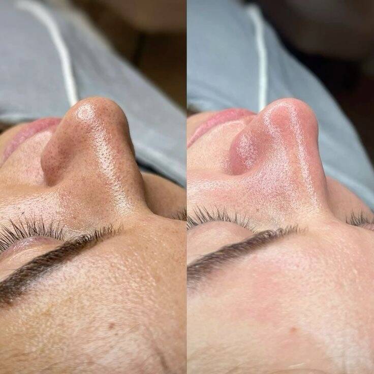 Косметолог Эстетист  в Иркутске фото 2 Услуги Иркутск