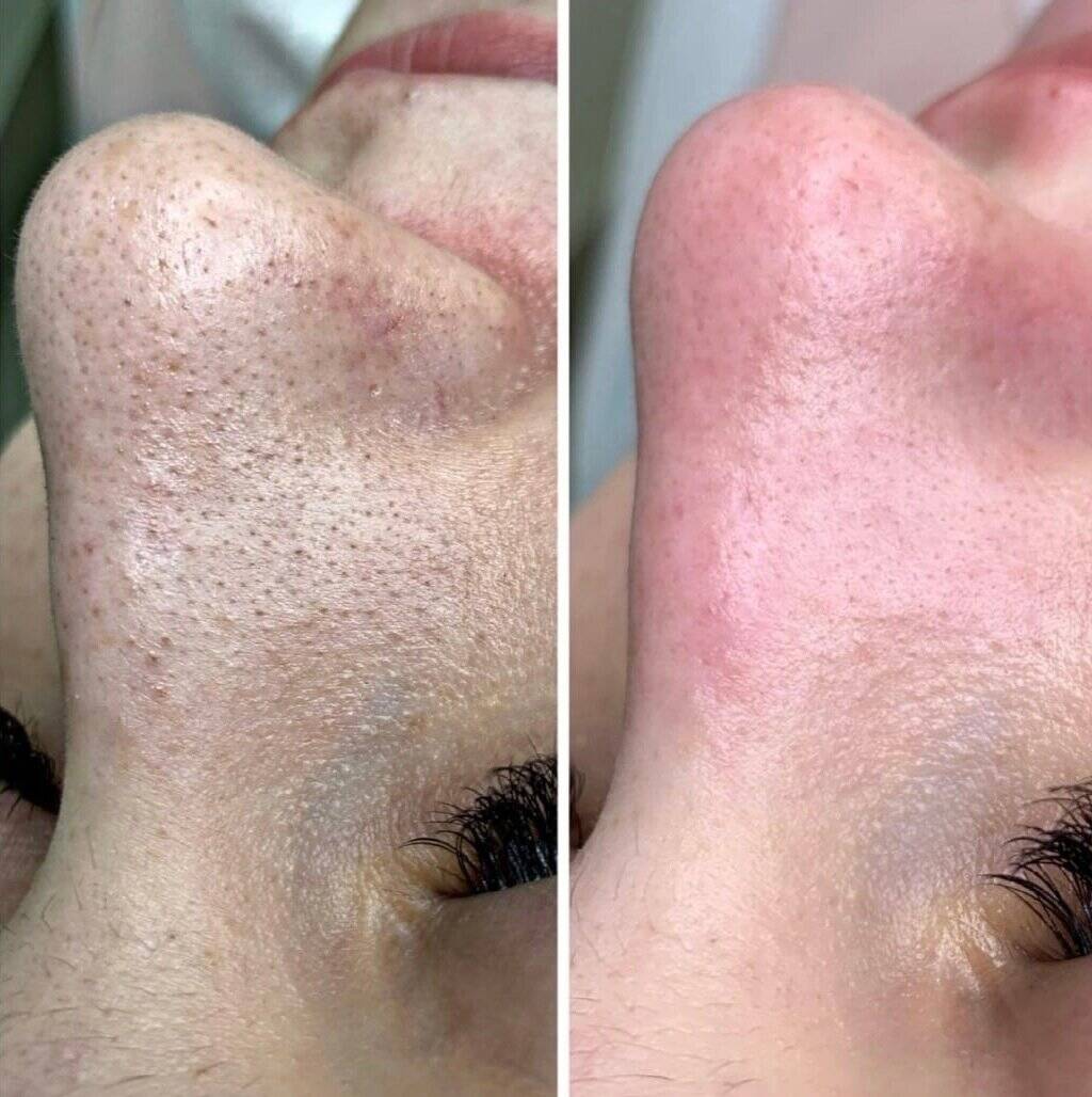 Косметолог Эстетист  в Иркутске фото 3 Услуги Иркутск