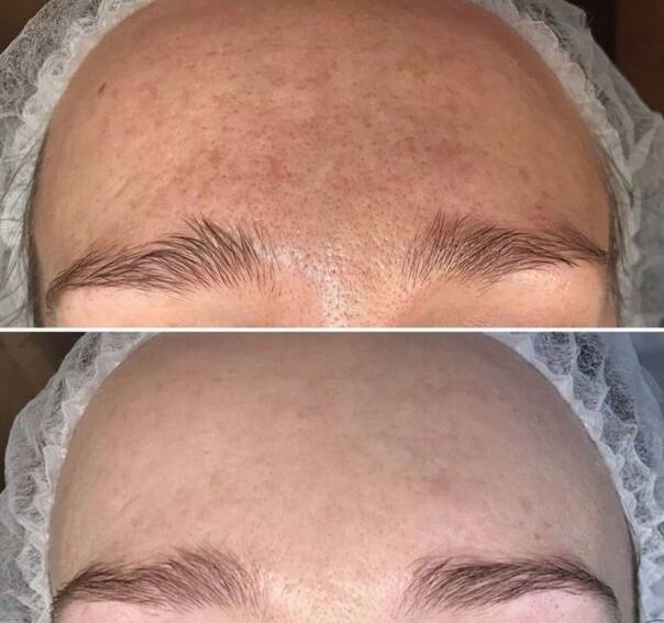 Косметолог Эстетист  в Иркутске фото 4 Услуги Иркутск