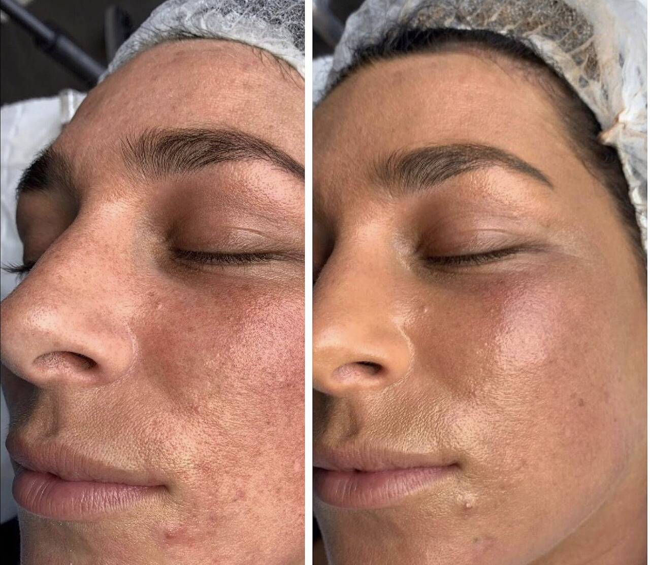 Косметолог Эстетист  в Иркутске фото 5 Услуги Иркутск