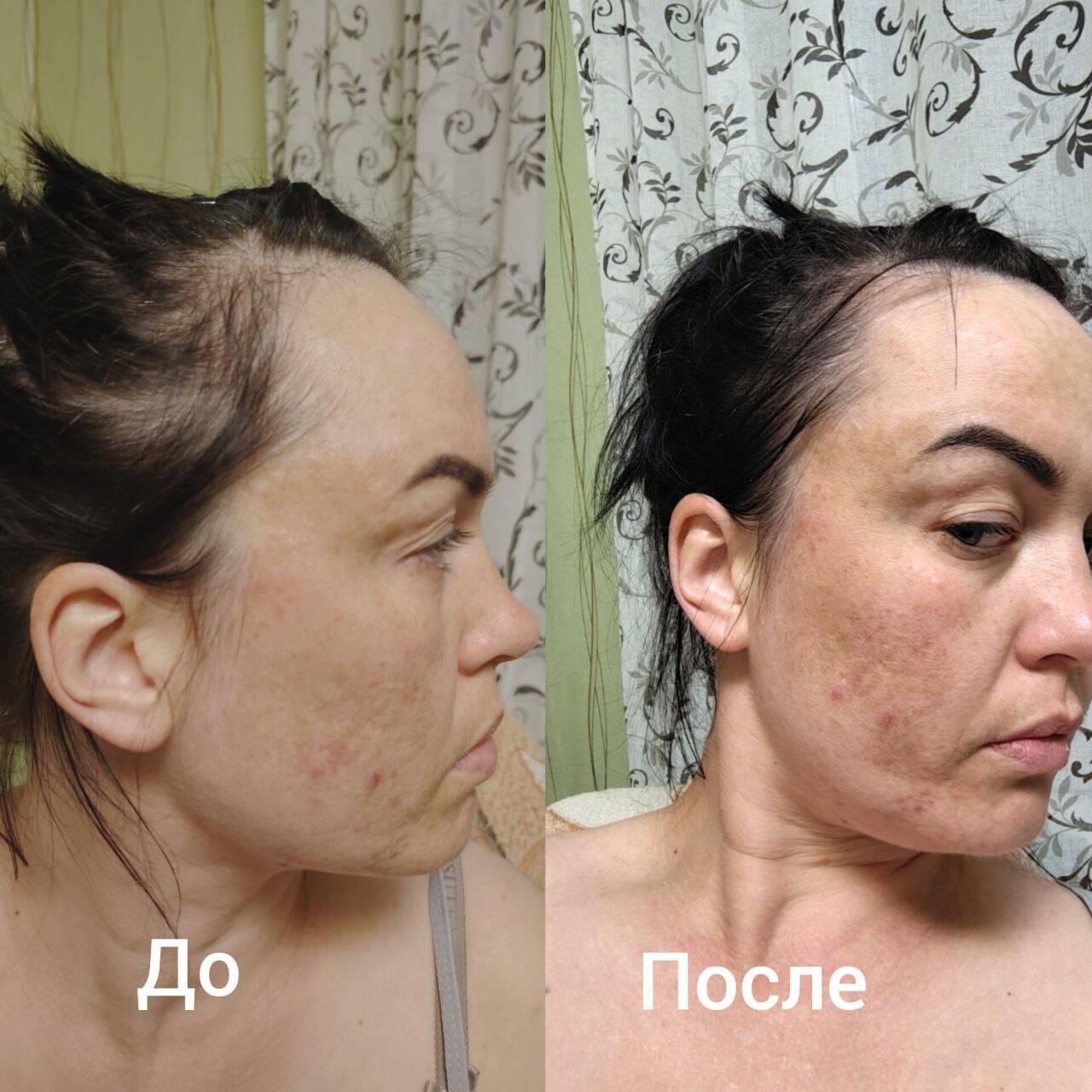 услуги косметолога-эстетиста в Новосибирске фото 4 Услуги Новосибирск