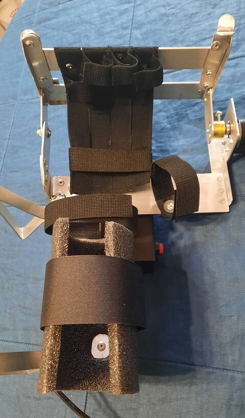 Реабилитация руки после инсульта в Москве фото 4 Услуги Москва