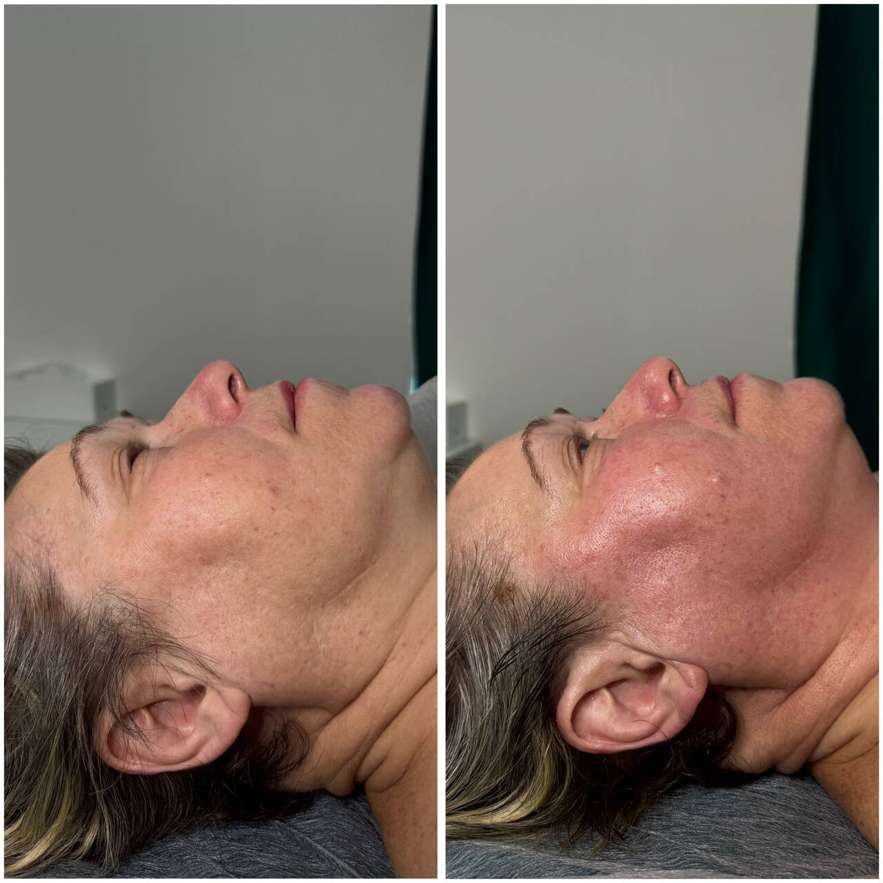 Массаж лица, эстетическая косметология в Санкт-Петербурге фото 6 Услуги Санкт-Петербург Массаж лица, эстетическая косметология в Санкт-Петербурге фото 6 Услуги Санкт-Петербург