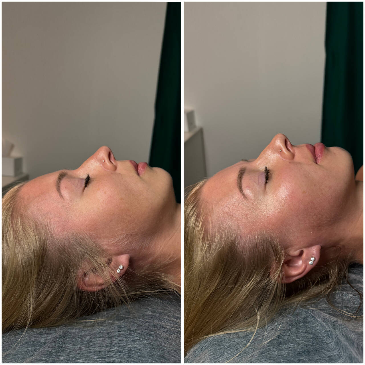 Массаж лица, эстетическая косметология в Санкт-Петербурге фото 2 Услуги Санкт-Петербург Массаж лица, эстетическая косметология в Санкт-Петербурге фото 2 Услуги Санкт-Петербург