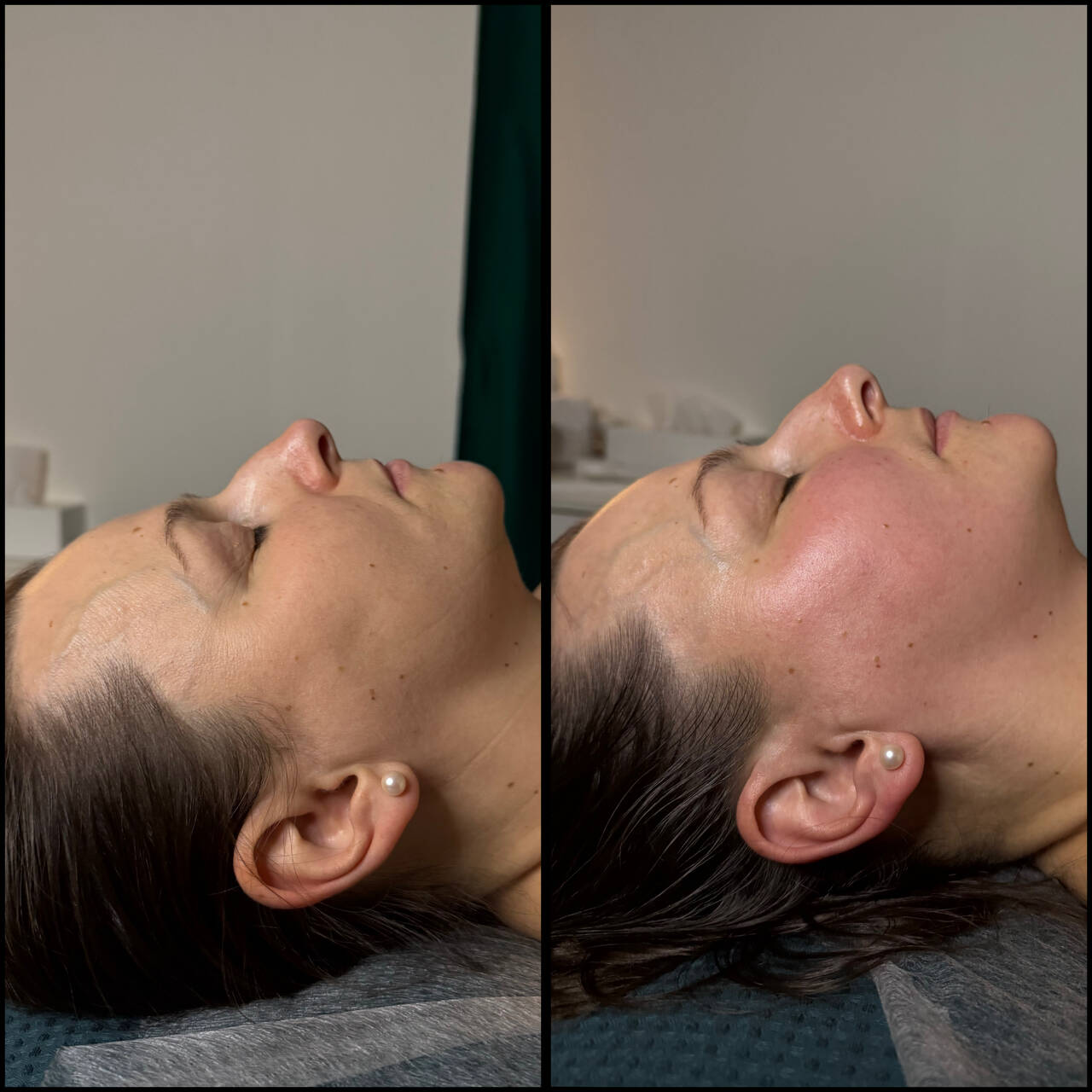 Массаж лица, эстетическая косметология в Санкт-Петербурге фото 4 Услуги Санкт-Петербург Массаж лица, эстетическая косметология в Санкт-Петербурге фото 4 Услуги Санкт-Петербург