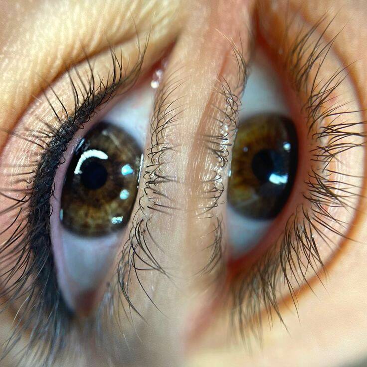 Перманентный макияж брови губы веки. Удаление татуажа ремувером в Краснодаре  в Краснодаре фото 5 Услуги Краснодар