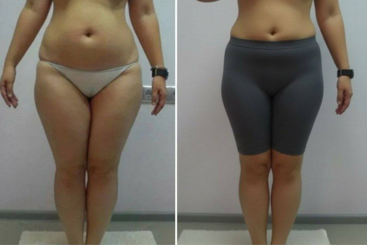 Корекция фигуры 