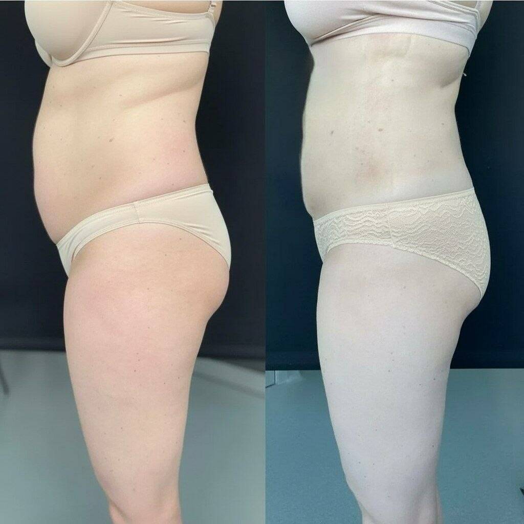 Корекция фигуры  в Старой Купавне фото 3 Услуги Старая Купавна