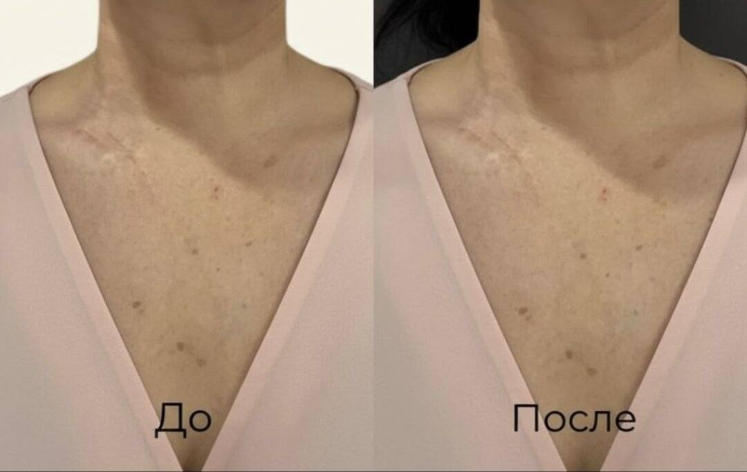 Корекция фигуры  в Старой Купавне фото 2 Услуги Старая Купавна