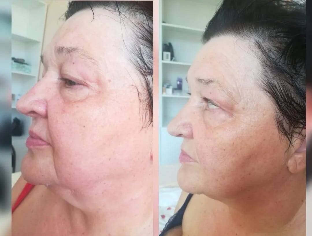 Массаж Шугаринг в Москве фото 2 Личные вещи Москва