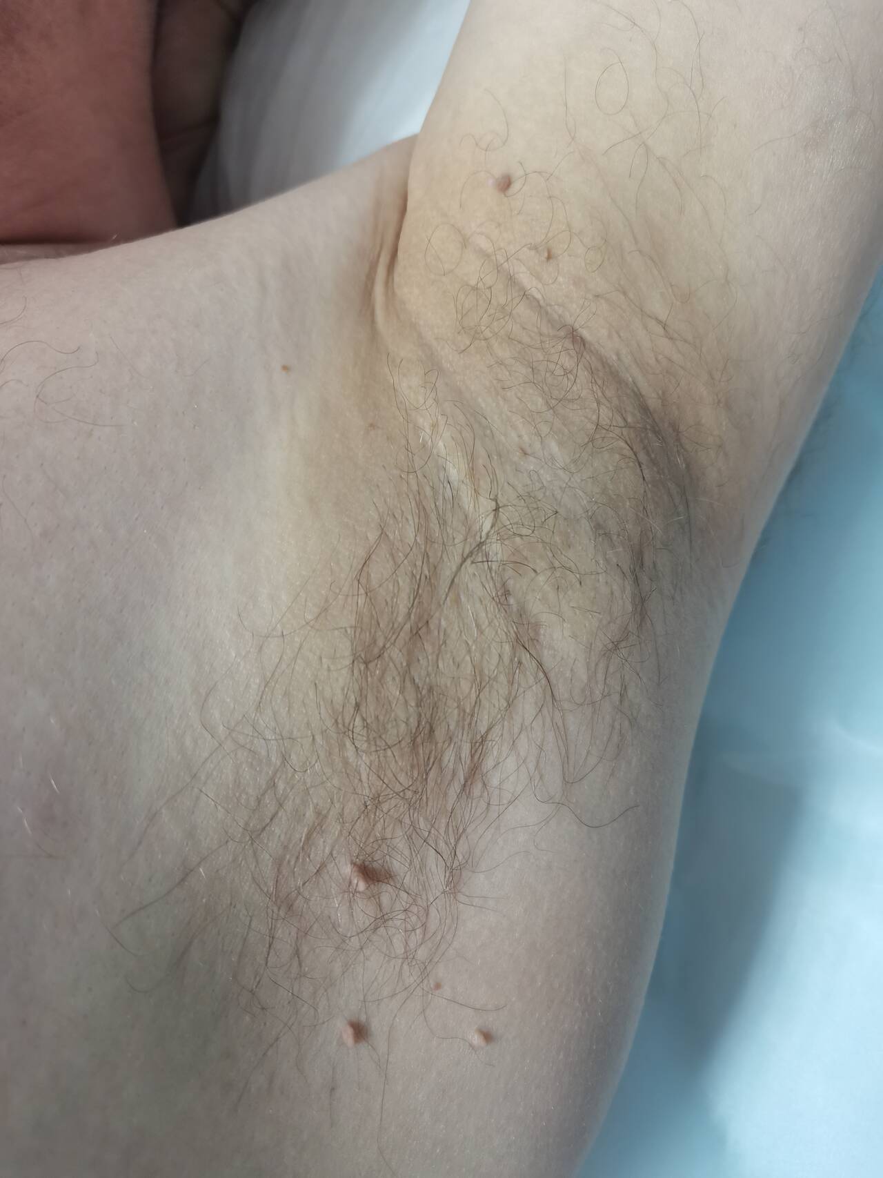 Депиляции/шугаринг в Подольске фото 6 Услуги Подольск