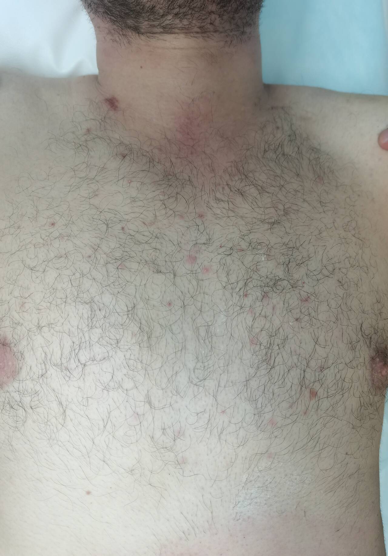 Депиляции/шугаринг в Подольске фото 7 Услуги Подольск