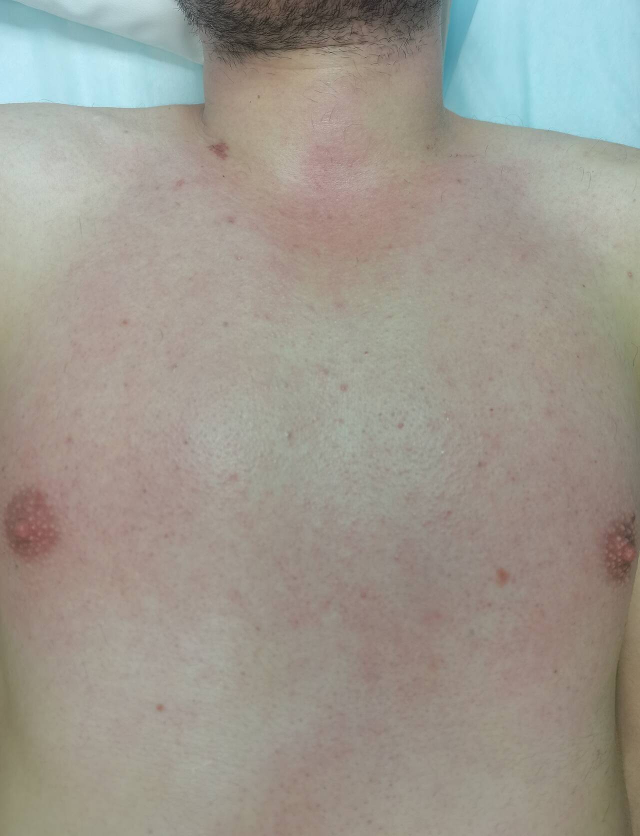 Депиляции/шугаринг в Подольске фото 4 Услуги Подольск