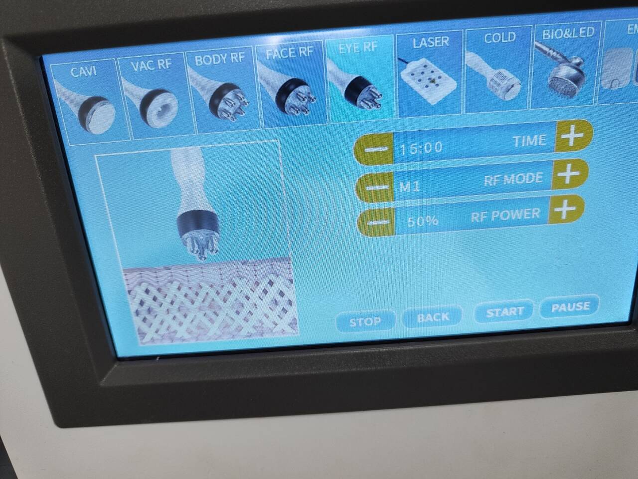 РФ лифтинг коррекция фигуры в Люберцах фото 2 Услуги Люберцы