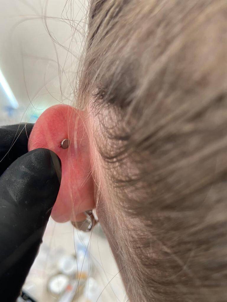 Пирсинг микродермалы восстановление проколов в Одинцово фото 2 Услуги Одинцово