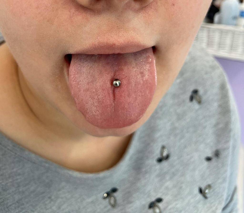 Пирсинг микродермалы восстановление проколов в Одинцово фото 4 Услуги Одинцово